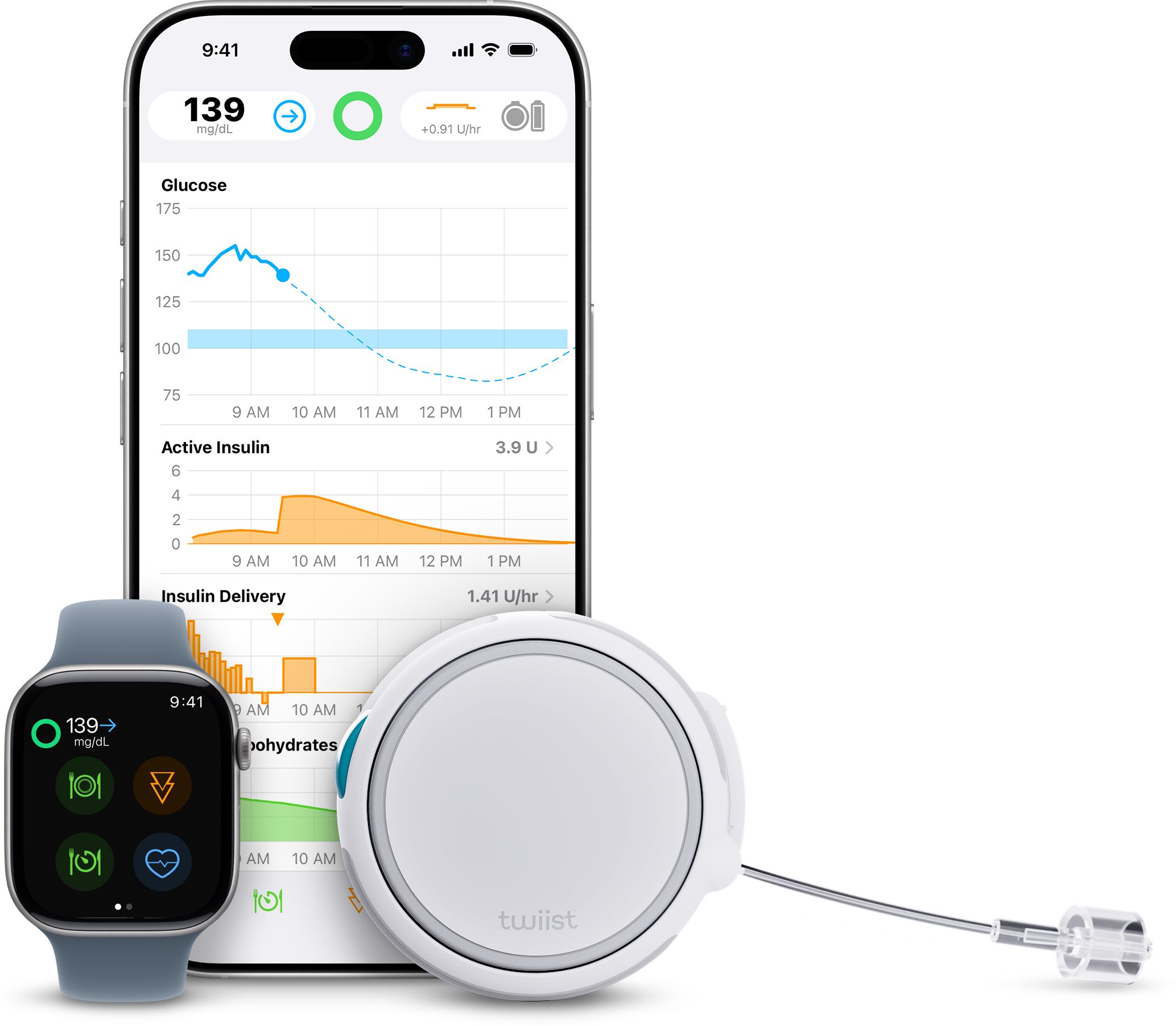 Eversense 365 cgm integrates with twiist automated insulin delivery systems